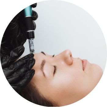 skin treatment - microneedling