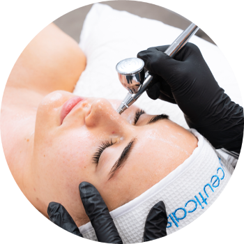 skin treatment - oxygen facial