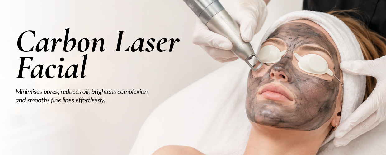 Carbon laser facial banner photo Carbon laser facial